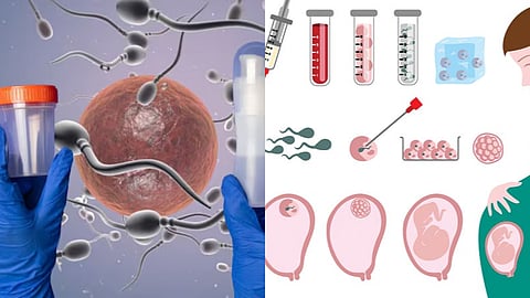 IVF