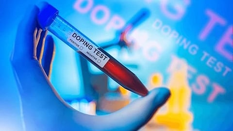 DOPING TEST