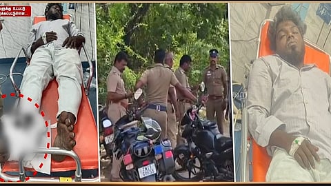 Police Shoot Rowdy After Attack on Officers in Chennai