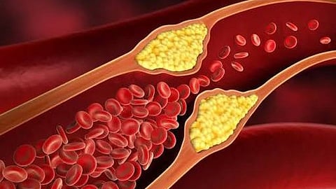 Cholesterol