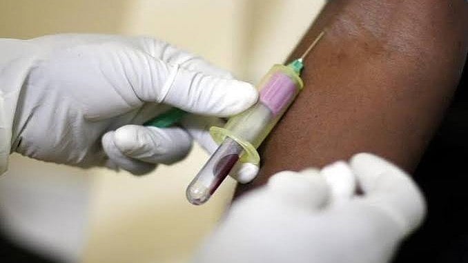 60 பேரில் ஒருவருக்கு HIV! அழகிய நாட்டை அதிரவைத்த அவசரநிலை! அதிர்ச்சி பின்னணி என்ன?