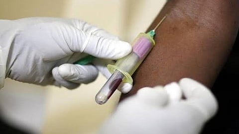 HIV