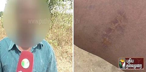 மறுவாழ்வு மையத்தில் கம்பால் அடித்து கொடுமை