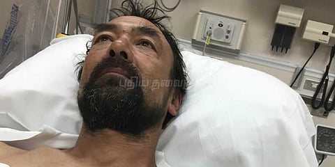 இதயத்தில் குத்திய ஆணியுடன் காரை ஓட்டி மருத்துவமனை சென்ற நபர்