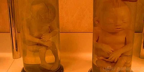 பாட்டிலுக்குள் புதைக்கப்பட்ட குழந்தைகள்: ஒரு அதிர்ச்சி சம்பவம் 