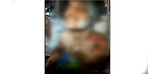 காதலியை மணக்க முடியாததால் இளைஞர் தீக்குளிப்பு !