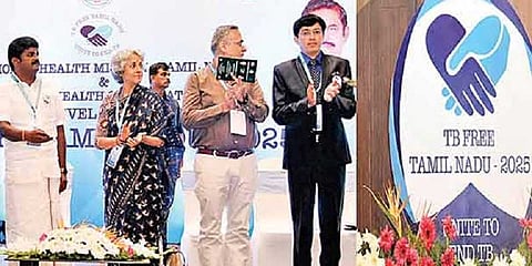 “காசநோய் இல்லாத மாநிலமாக தமிழகம் உருவாக்கப்படும்” - அமைச்சர் விஜயபாஸ்கர்