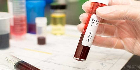 ஹெச்.ஐ.வி ரத்தம்:‌ மேலும் ஒரு பெண் புகார்