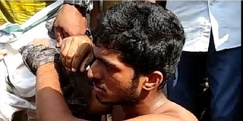 இளம் பெண் மீது பெட்ரோல் உற்றி எரித்த கொடூர இளைஞன் 