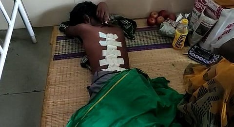 பள்ளியிலும் தொடரும் சாதிய கொடுமை?: மாணவனை பிளேடால் கீறிய சக மாணவர் !