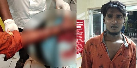 “என் மீது புகார் அளித்தால் செத்துவிடுவேன்” - காவல்நிலையம் முன்பு கையை அறுத்துக்கொண்ட கணவர் 