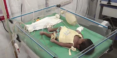 தடுப்பூசி போட்டதால் குழந்தை உயிரிழந்ததாக புகார் - மருத்துவமனையை முற்றுகையிட்ட உறவினர்கள் 