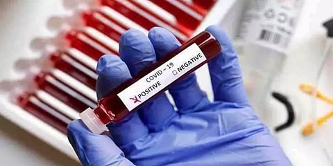 புதுச்சேரியில் நாளுக்கு நாள் அதிகரிக்கும் கொரோனா பாதிப்பு