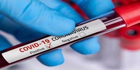 அயனாவரம் காவல் நிலையத்தில் 15 பேருக்கு கொரோனா !