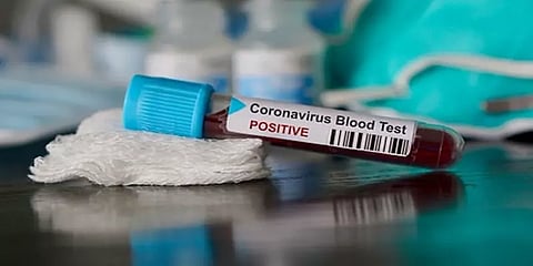 திட்டக்குடி திமுக எம்எல்ஏ கணேசனுக்கு கொரோனா தொற்று !
