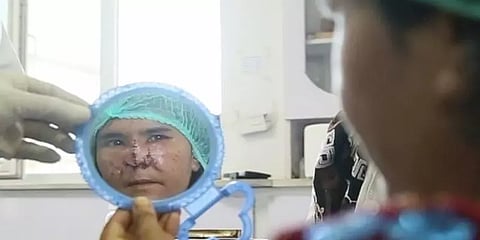 மனைவியின் மூக்கை அறுத்த கொடூர கணவன் !