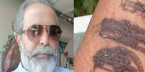 விமான நிலைய அடையாள மையால்  கையில் அலர்ஜி - காங்கிரஸ் தலைவர் மது யாஸ்கி புகார்