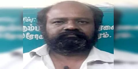 மதுரை: குடும்பத் தகராறில் தூங்கிக்கொண்டிருந்த மனைவிக்கு கணவனால் நேர்ந்த சோகம்