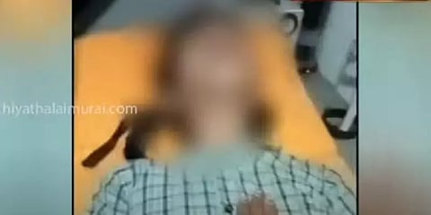5ஆம் வகுப்பு மாணவியை உதைத்து காயப்படுத்திய மற்றொரு மாணவியின் தாய்மீது வழக்குப்பதிவு