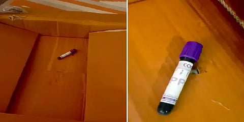 VIRAL VIDEO: நாற்காலி ஆர்டர் செய்த மாணவர்..ரத்த மாதிரி குப்பியும் டெலிவரி ஆனதால் அதிர்ச்சி
