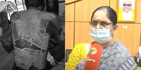 Multi Organ Failure கூட நடக்கும்... எச்சரிக்கும் மருத்துவர் #Toxic Epidermal Necrolysis
