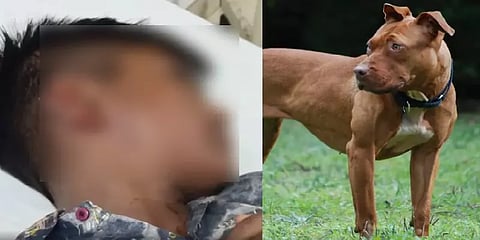 மீண்டும் பயங்கரம் - சிறுவனின் காதை துண்டாக எடுத்த பிட்புல் நாய்!