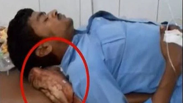مریض کے سر کے نیچے اس کے کٹے ہوئے پیر کے ساتھ کی تصویر 