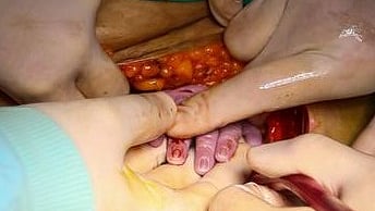 تصویر ڈی ڈبلیو ڈی