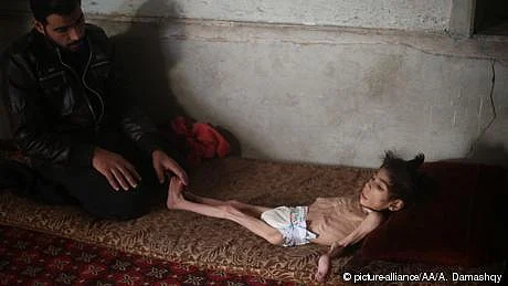 دنیا بھر میں بیاسی کروڑ انسان بھوک اور کم خوراکی کا شکار