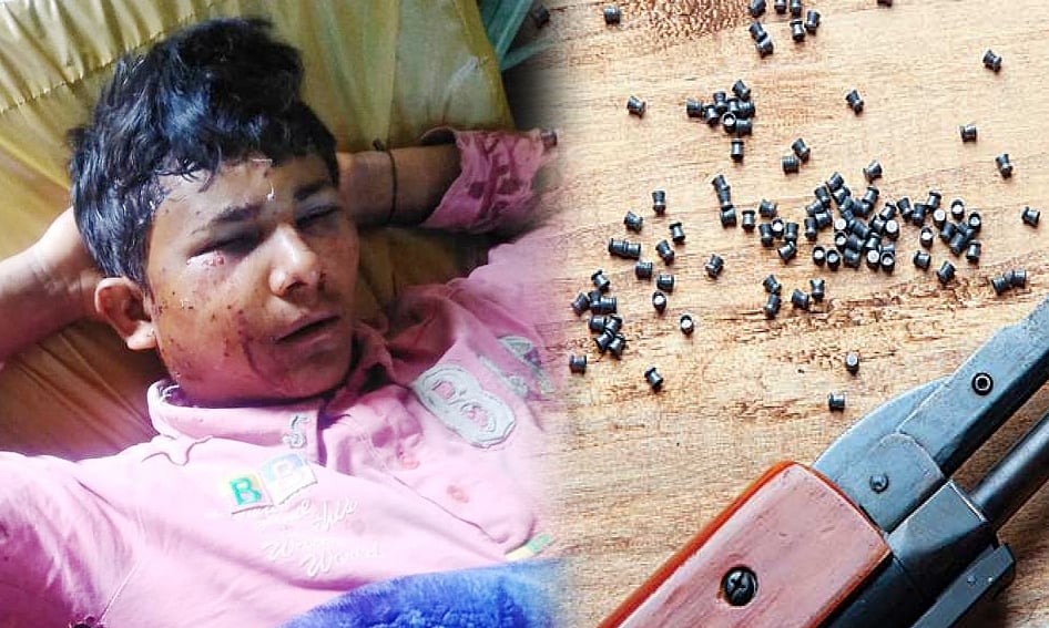 کشمیر: پیلٹ گن کا نشانہ بننے والا بہار کا کمسن مزدور بینائی سے محروم