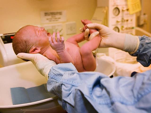 امریکہ میں آدھے سے زائد نوزائیدہ بچوں کے ختنے، جانیں کیوں؟