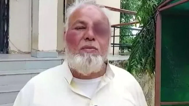 تصویر سوشل میڈیا