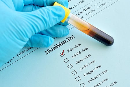 اتر پردیش میں کورونا کے ساتھ ایک نئی آفت کا قہر، سبھی اسپتال الرٹ پر