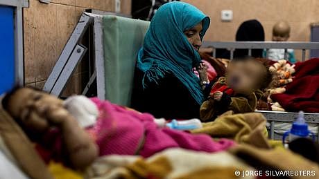 افغانستان لاکھوں بچے شدید غذائی قلت کا شکار
