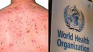کینیا میں ’ایم پاکس‘ کے کیسز میں اضافہ، محکمہ صحت کی ایڈوائزری جاری