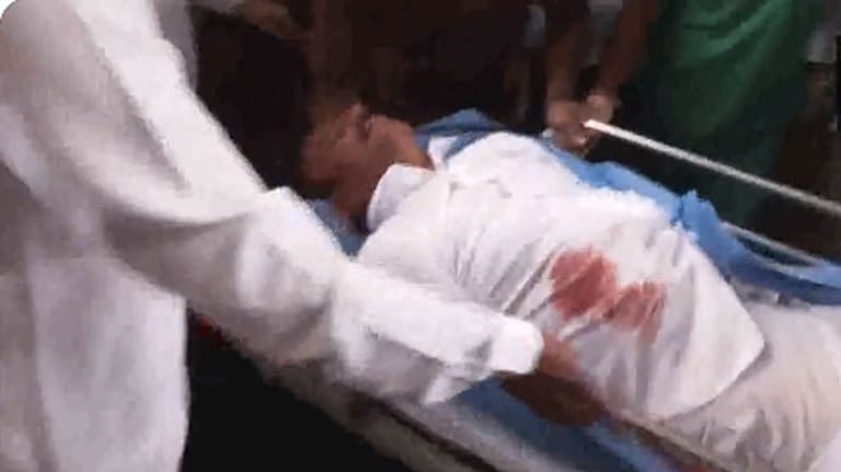 تلنگانہ: انتخابی تشہیر کے دوران بی آر ایس رکن پارلیمنٹ پر چاقو سے حملہ، اسپتال میں داخل