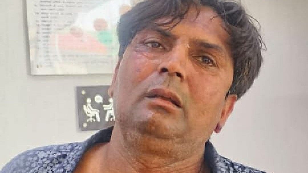 وزیر اعلیٰ ریکھا گپتا پر حملہ کرنے والا بمشکل قابو میں آیا، تھپڑ مارنے کے ساتھ ساتھ بال بھی پکڑ کر کھینچے