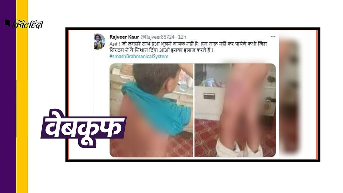 ये फोटो यमन के एक बच्चे की है न कि गाजियाबाद के लड़के की 