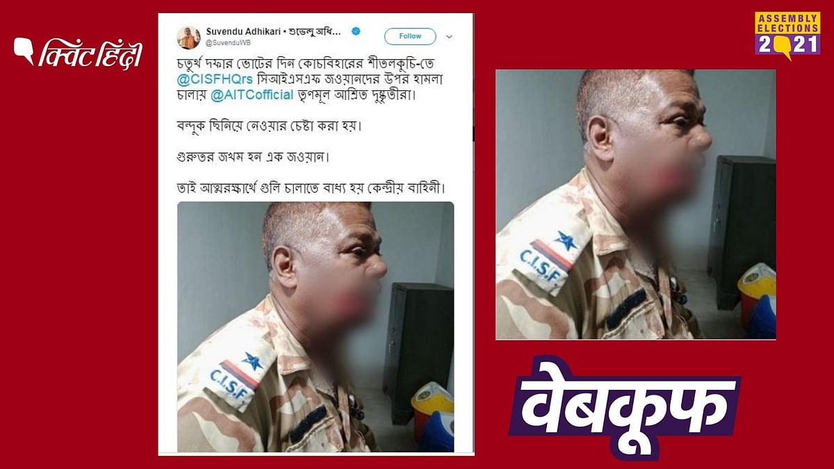 वायरल फोटो में दिख रहे घायल जवान पर लंगूरों ने हमला कर कर दिया था