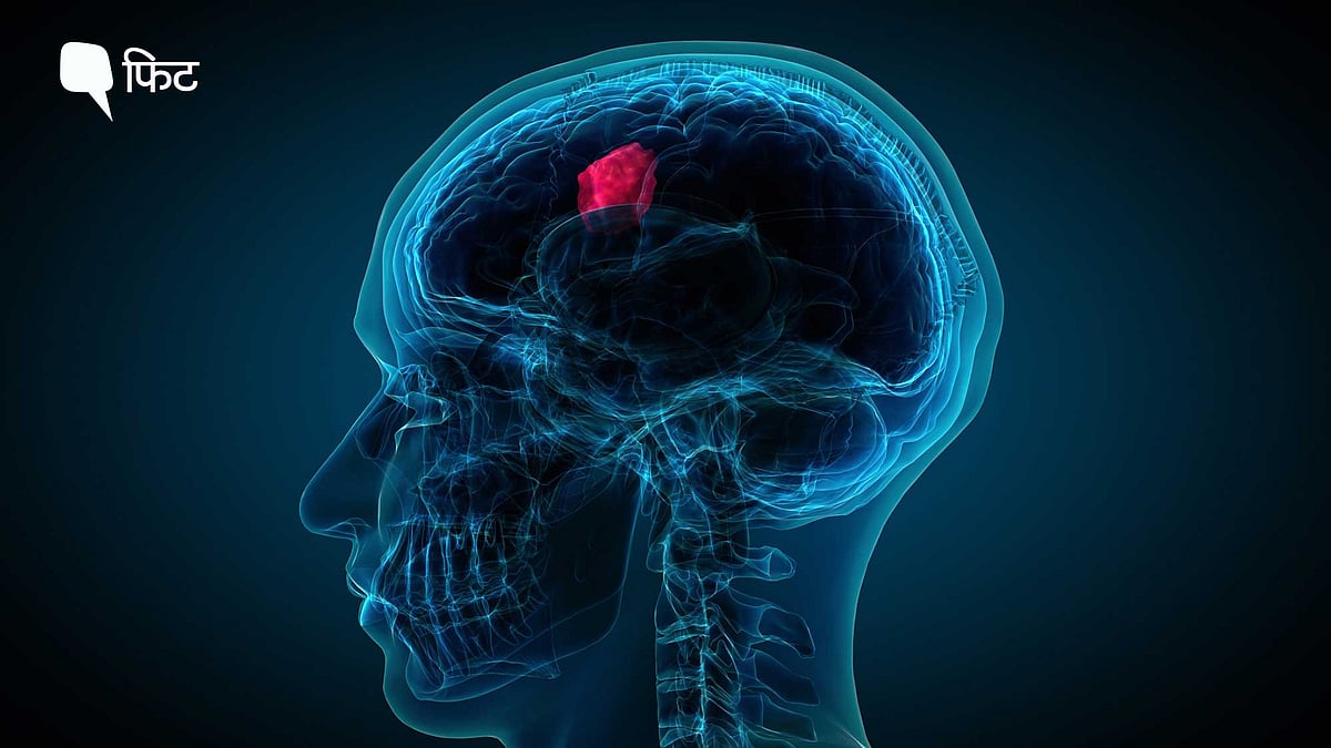 <div class="paragraphs"><p>Brain Tumour Day पर जानें इलाज के नए तकनीकों के बारे में.</p></div>
