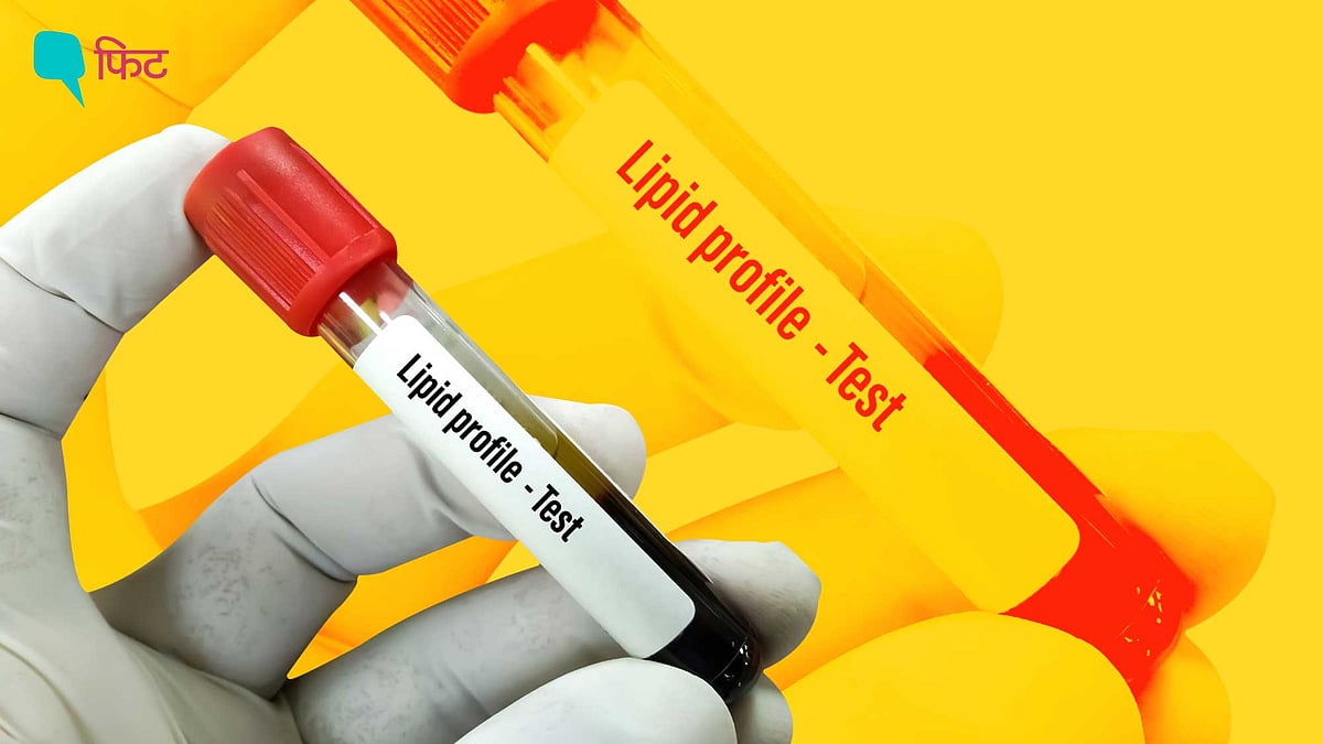 <div class="paragraphs"><p>Lipid Profile Test बताए शरीर में कोलेस्ट्रॉल की मात्रा</p></div>