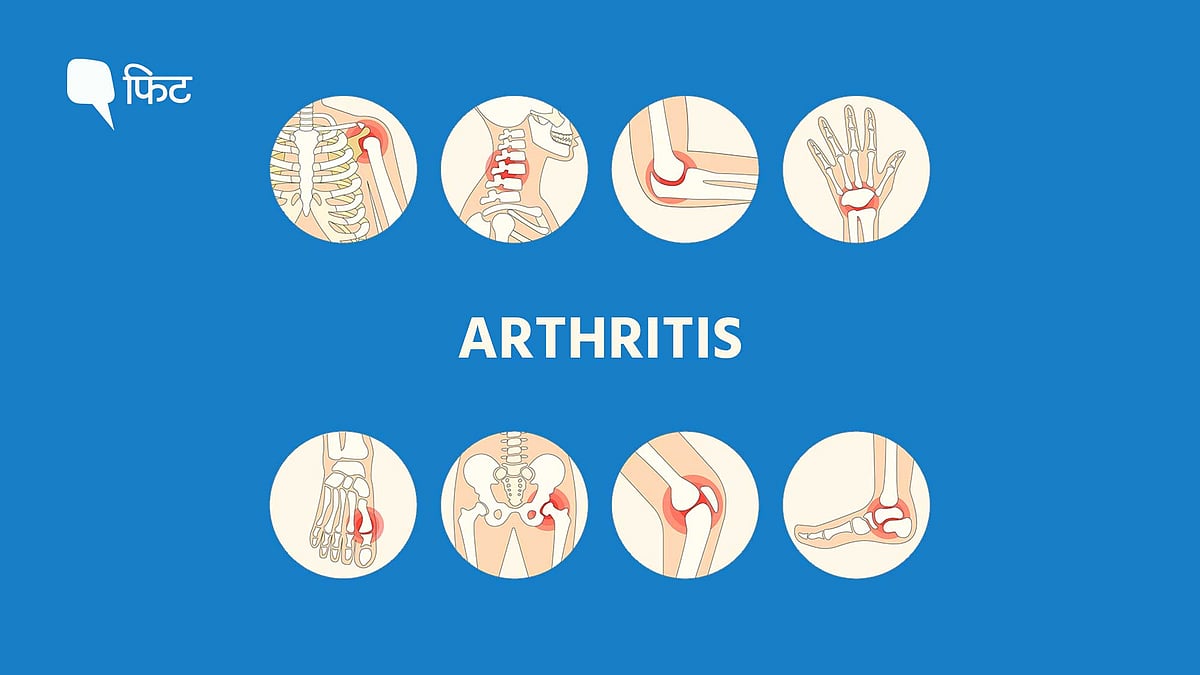 <div class="paragraphs"><p>World Arthritis Day:&nbsp;युवाओं में आर्थराइटिस की समस्या बढ़ रही है. ऐसे करें पहचान और इलाज.&nbsp;</p></div>