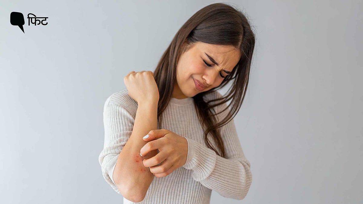 <div class="paragraphs"><p>Atopic Eczema Day: एटोपिक एक्जिमा को ऐसे करें मैनेज?</p></div>