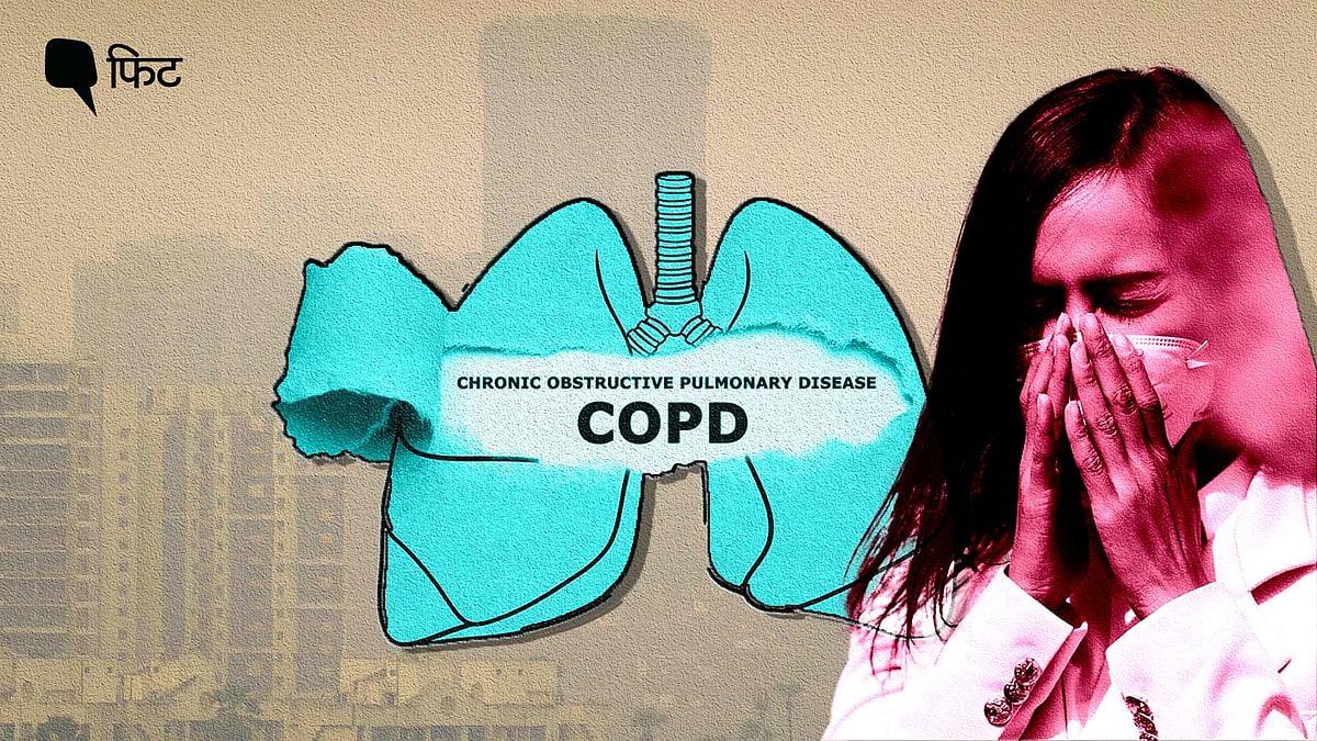 <div class="paragraphs"><p>सीओपीडी (chronic obstructive pulmonary disease) जिसे काला&nbsp;दमा भी कहते हैं.</p></div>
