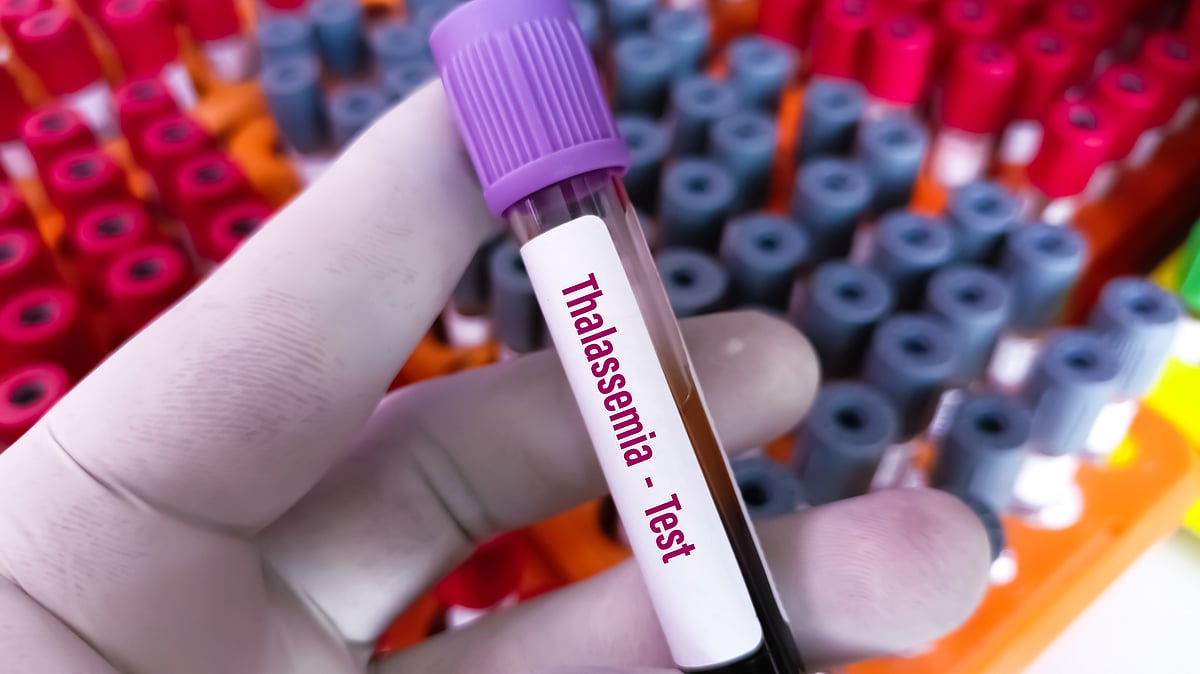 <div class="paragraphs"><p><strong>Thalassemia Test: </strong>हर दंपती को थैलसीमिया के बारे में जागरूक बनाने की जरूरत है.</p></div>