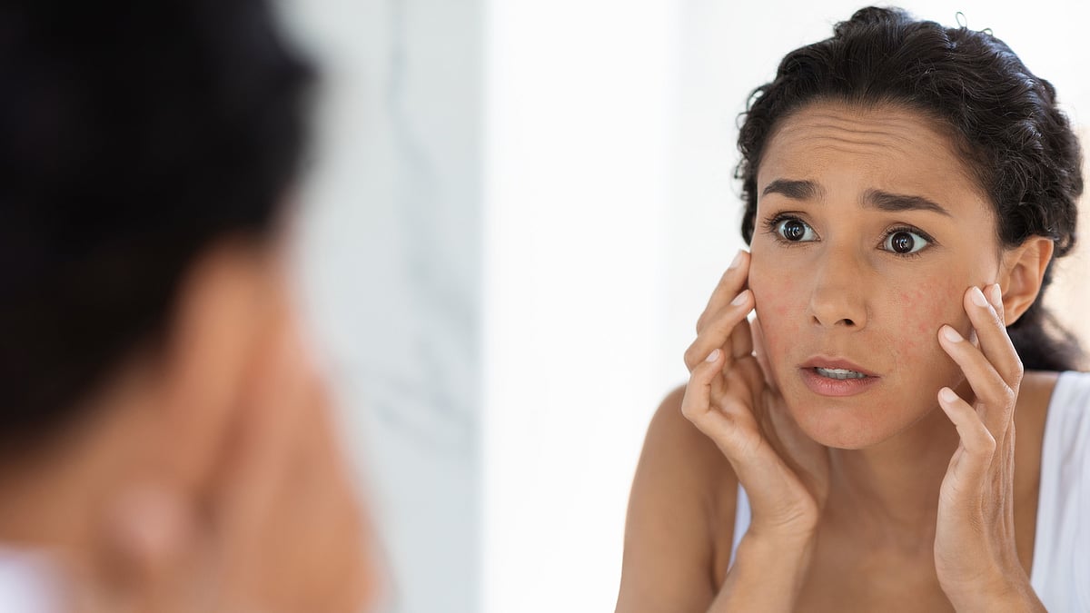 <div class="paragraphs"><p>Pimple Problem: क्या आपकी स्किन पर नियमित रूप से मुहांसे निकलते रहते हैं?</p></div>