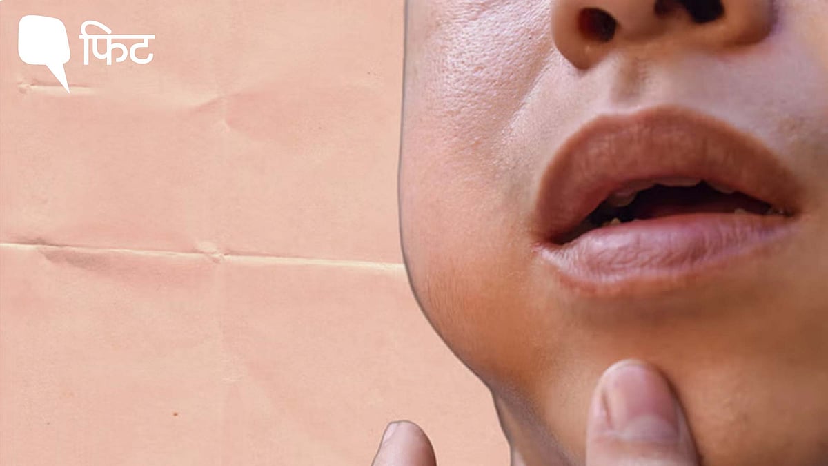 <div class="paragraphs"><p>Mumps Outbreak in Delhi: क्या हैं मंप्स के लक्षण?</p></div>