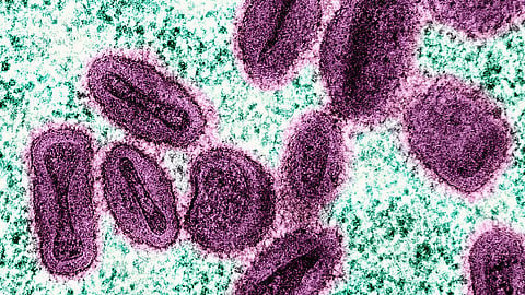 Mpox - apkoppor - smittar främst genom sexuella kontakter.