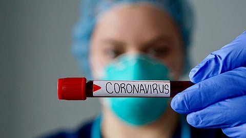 WHO tvrdí, že koronavírus je stále rovnako patogénny, na sile nestratil.
