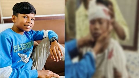 Sahdev Dirdo Road Accident: 'बचपन का प्यार फेम' सहदेवचा अपघात; डोक्याला गंभीर दुखापत... 